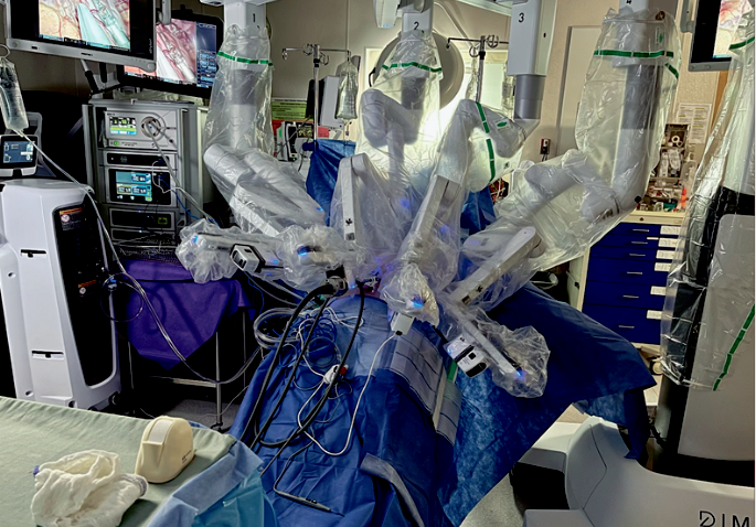 A picture of Mikka while in surgery with the robotic system in place. Dr. Bigsby control the arms robotically off to the side of the room. The robotic surgery allows a much less invasive surgery to help minimize pain and speed up the healing process. This cancer is so hard to detect that it was not seen on her cat scan or PET Scan and even to the surgeons upon surgical removal and seeing the stomach and examining it, it appeared to be entirely healthy and nothing was suspicious looking. But pathology after surgery revealed 10 spots of cancer lurking in her stomach.<br />
